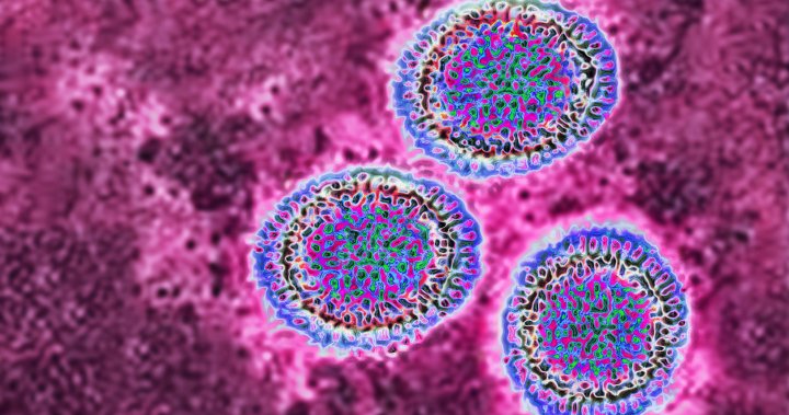 Australia had its worst flu season on record. Is it a warning for Canada? – National | Globalnews.ca