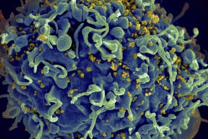 HIV programs’ U.S. funding must be replaced to avoid millions of deaths: UN – National | Globalnews.ca