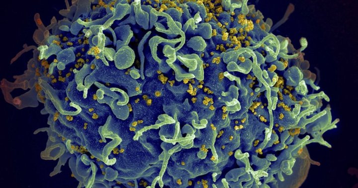 HIV programs’ U.S. funding must be replaced to avoid millions of deaths: UN – National | Globalnews.ca