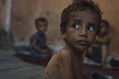 Canadian aid agency workers call for action saying starvation is rampant in Gaza – National | Globalnews.ca