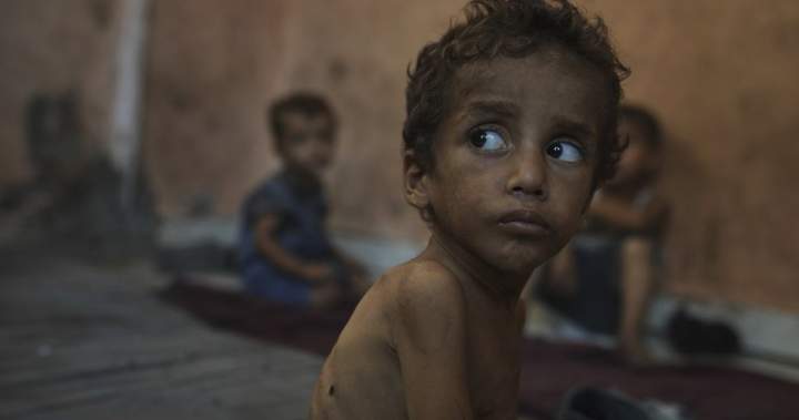 Canadian aid agency workers call for action saying starvation is rampant in Gaza – National | Globalnews.ca